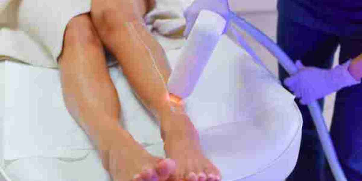 Laser Hair Removal for Smooth Skin with Natural Finish